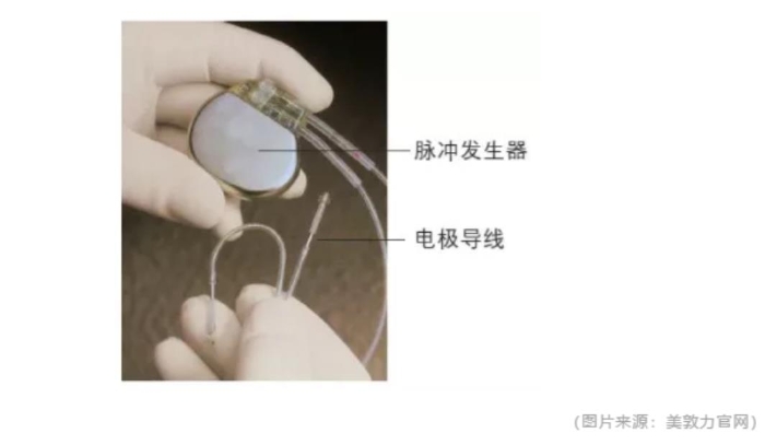 心脏备用小马达心脏起搏器您了解吗