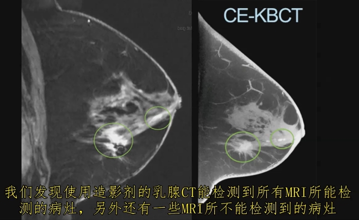 KBCT产品优势6