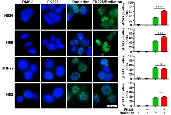 表观遗传因子FK228显著增强放疗耐受细胞H526和H69放疗效果