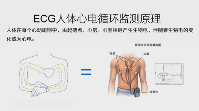图1：ECG心电监测原理