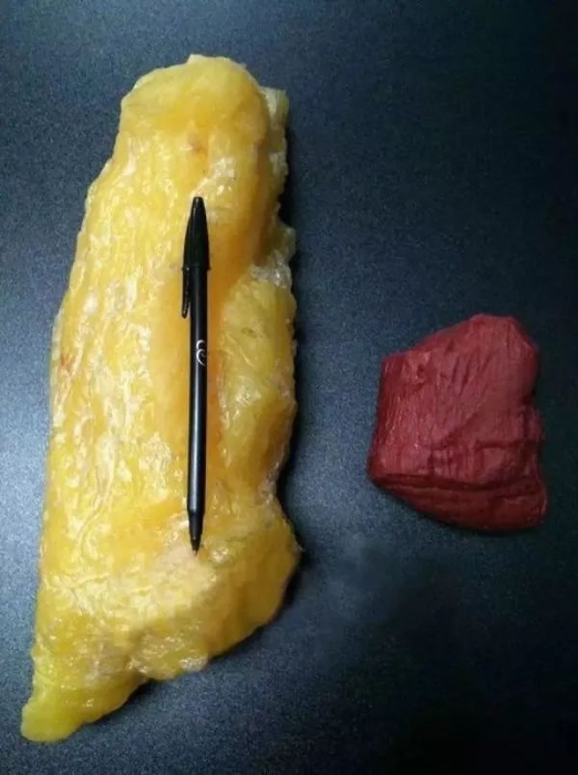 怎么称体重最显瘦？称体重也要选对时间