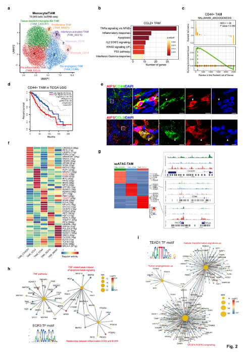 图1.脊髓室管膜瘤肿瘤相关巨噬细胞分类和研究