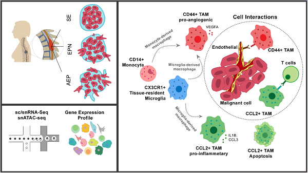 图2.脊髓室管膜瘤肿瘤微环境多种细胞的互作模式