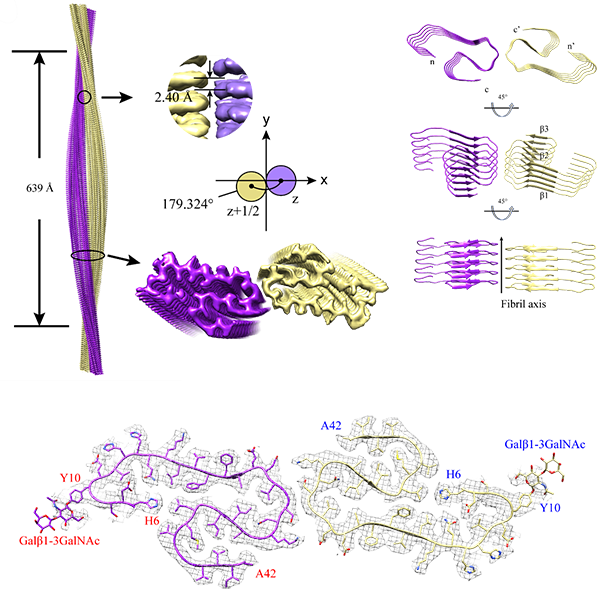 Galβ1-3GalNAc糖型Aβ淀粉样纤维的电镜结构图