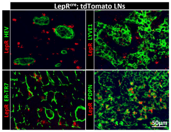 荧光显微照片显示HEV和淋巴管周围的一类特殊的表达瘦素受体的基质细胞亚群 荧光显微照片显示HEV和淋巴管周围的一类特殊的表达瘦素受体的基质细胞亚群